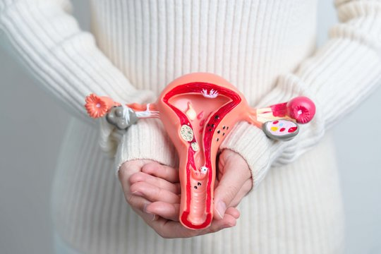 Endometriose - Dra. Laís Fonseca